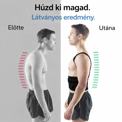 Postupro™ – Testtartásjavító